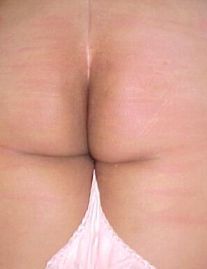 red cane marks on Bethie's beautiful bottom