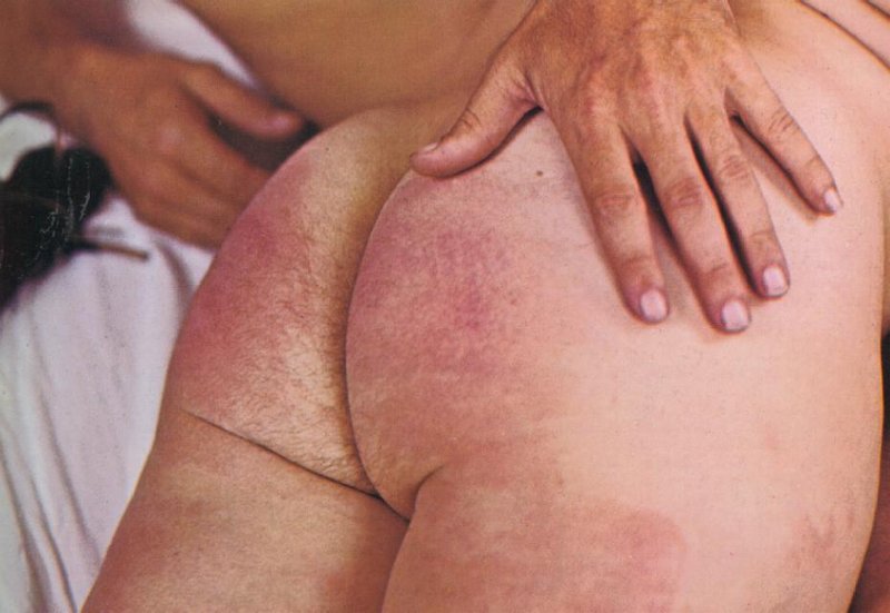 well spanked bottom